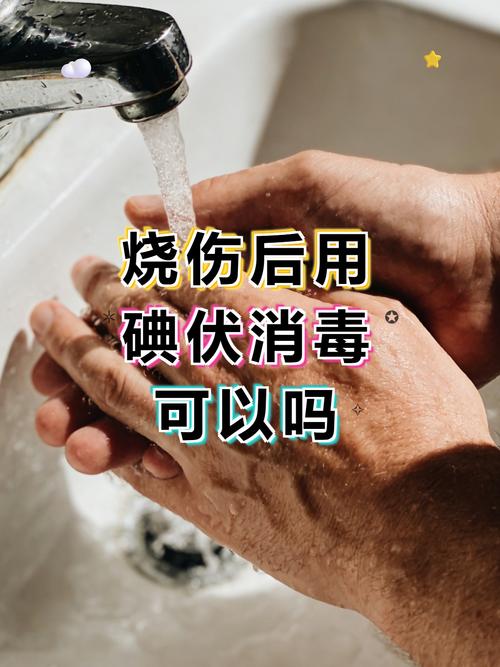 烧伤后用碘伏消毒可以吗