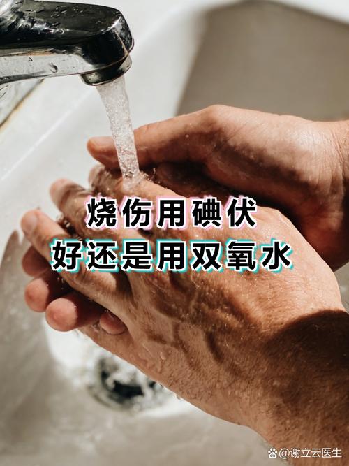 烧伤用碘伏好还是用双氧水