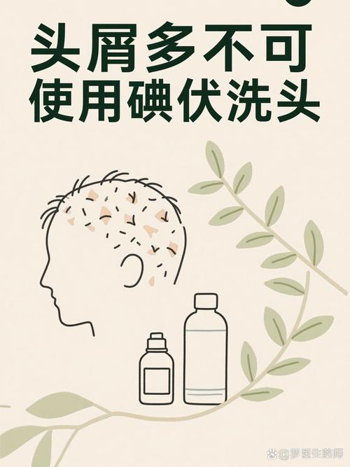 头皮屑特别多可以用碘伏洗头吗